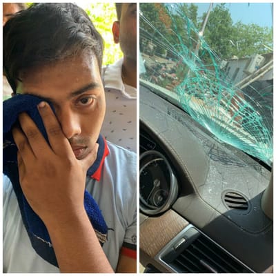 બિહારના પટનામાં તેજ પ્રતાપ યાદવના સિક્યુરિટી ગાર્ડ દ્વારા મીડિયાકર્મની પર હુમલો, પોતાનો બચાવ કરતા કહ્યું કે મને મારવા આવ્યા હતા