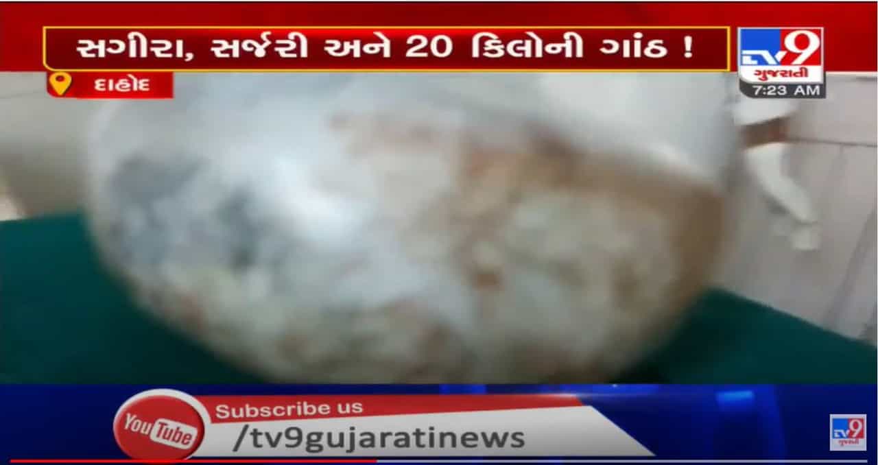 દાહોદમાં સગીરાના પેટમાંથી નીકળી 20 કિલોની ગાંઠ, તબીબોએ સફળતાપૂર્વક જટિલ ઓપરેશન કર્યું