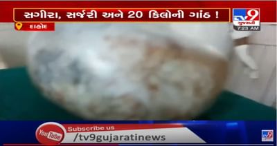 દાહોદમાં સગીરાના પેટમાંથી નીકળી 20 કિલોની ગાંઠ, તબીબોએ સફળતાપૂર્વક જટિલ ઓપરેશન કર્યું