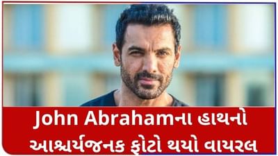 John Abraham ના હાથની આશ્ચર્યજનક તસ્વીર થઈ વાયરલ, ફોટો જોઈ ચાહકો પણ ચોંકી ગયા!