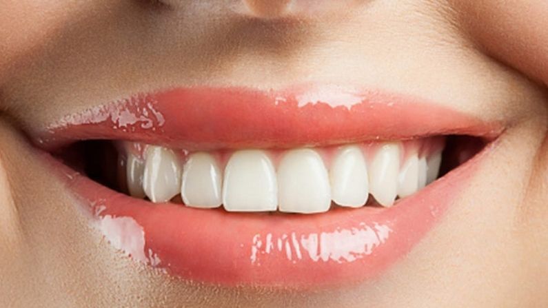 HEALTH TIPS: શું પીળા દાંતની સમસ્થયાથી પીડીત છો?, આટલું કરો અને દાંતને સફેદ અને ચમકદાર બનાવો
