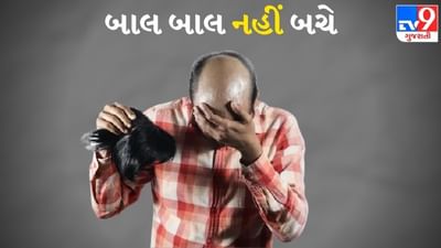 વિગ પહેરીને યુવકે કરી લીધા લગ્ન, એક વર્ષ બાદ ભેદ ખુલ્યો તો પત્નીએ માંગ્યા છૂટાછેડા