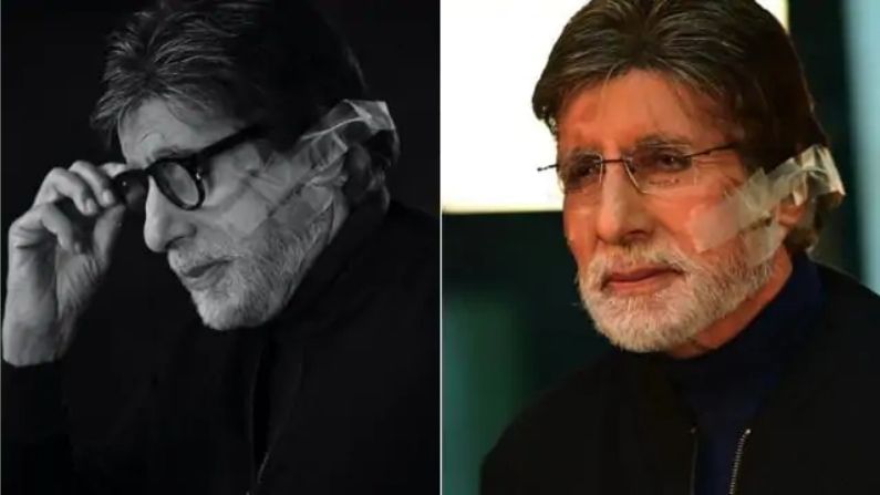 Amitabh Bachchanને સર્જરી બાદ લખ્યો બ્લોગ, ફેન્સને કહી આ વાત