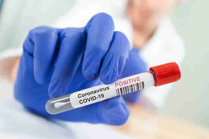 Gujarat Corona Update: રાજ્યમાં કોરોનાના 12,064 નવા પોઝિટિવ કેસ નોંધાયા અને 119 દર્દીઓનાં થયા મોત