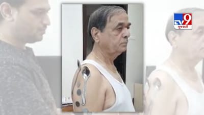 Magnet Man: કોરોના વેક્સિનનો બીજો ડોઝ લગાવ્યા બાદ શરીર બન્યું ચુંબક! સ્ટીલના વાસણો ચોંટવા લાગ્યા શરીરે