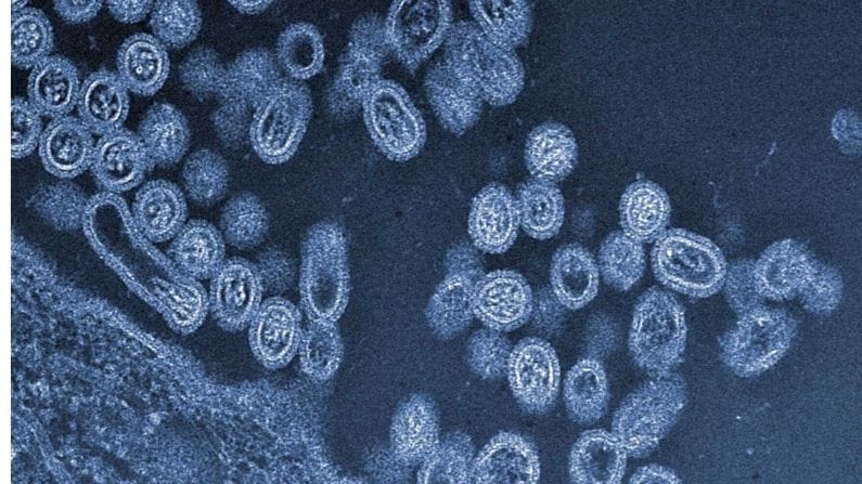 કોરોના મહામારી વચ્ચે ચીનમાં Bird Fluથી સંક્રમિત થયો માનવ, દુનિયાનો પ્રથમ કિસ્સો