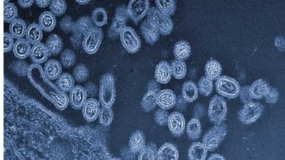 કોરોના મહામારી વચ્ચે ચીનમાં Bird Fluથી સંક્રમિત થયો માનવ, દુનિયાનો પ્રથમ કિસ્સો