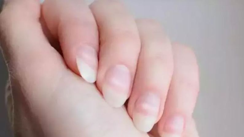 COVID nails:  કોરોનામાંથી સ્વસ્થ થયા બાદ દર્દીઓના નખના રંગ બદલાઇ રહ્યાં છે, હાથ અને અંગૂઠામાં દેખાતા નવા ગંભીર લક્ષણો