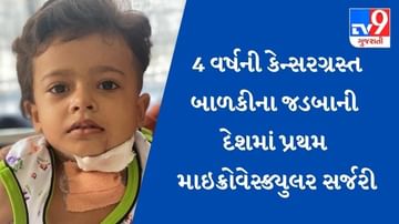 AHMEDABAD : દેશમાં સૌપ્રથમ  4 વર્ષની કેન્સરગ્રસ્ત બાળકીના જડબાની માઇક્રોવેસ્ક્યુલર સર્જરી, પગનું હાડકું કાપી જડબામાં લગાડવામાં આવ્યું