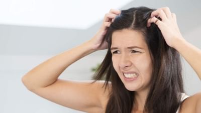 Home Remedies to Get Rid of Dandruff Naturally: પ્રદૂષણ અને વાળની યોગ્ય સાર-સંભાળના અભાવના કારણે લોકો ખોડા (dandruff)ની સમસ્યાથી પીડાતા હોય છે. અવનવી હેર સ્ટાઈલ કરવા માટે વપરાતા કેમિકલ યુક્ત હેર પ્રોડક્ટસ પણ ક્યારેક આ ડેન્ડ્રફની સમસ્યા માટે જવાબદાર હોય છે. આ ખોડાની સમસ્યાથી બચવા માટે લોકો ઘરેલુ નુસખા અજમાવતા હોય છે તો ચાલી જાણીએ આ સમસ્યાથી બચવા માટે કેટલાક ઘરગુથ્થું ઉપચાર વિશે
