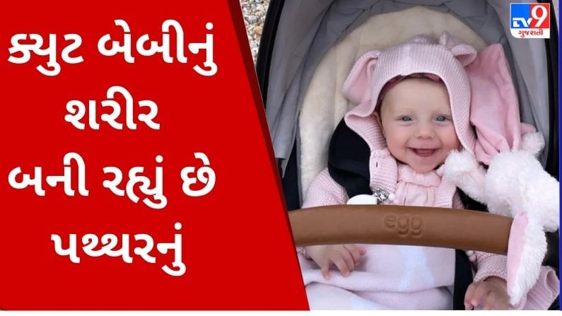 એવું તો શું થયું કે આ બાળકીનું શરીર બદલાઈ રહ્યું છે પથ્થરમાં, જાણો સમગ્ર વિગત