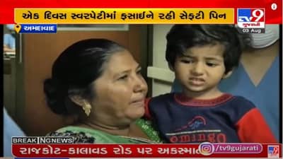Ahmedabad : સોલા સિવિલ હોસ્પિટલે એક યુનિક ઓપરેશન કરી એક બાળકીનો જીવ બચાવ્યો