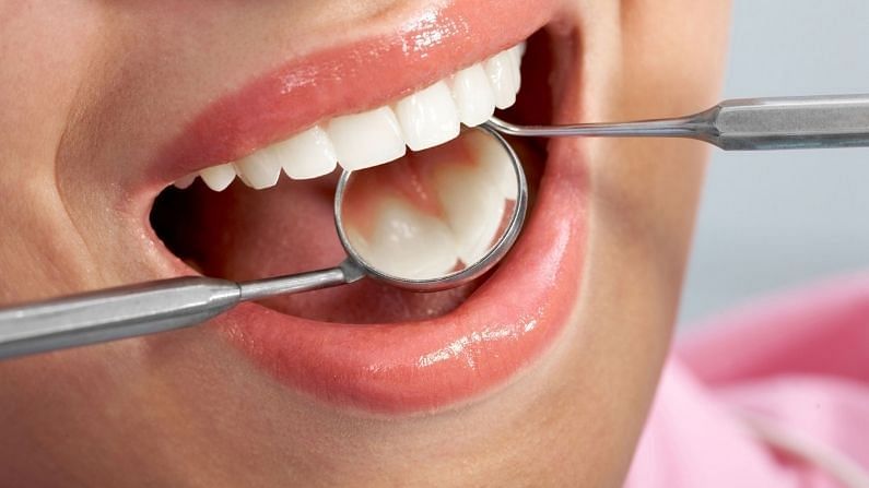 Dental Care : શું તમને દાંતની આ સમસ્યાની પીડા છો, તો આ ઉપાય અજમાવો