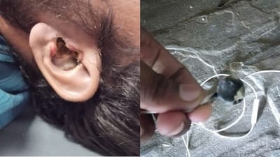 કાનમાં Earphone લગાવતા પહેલા થઈ જાઓ સાવધાન! Earphone બ્લાસ્ટે લઈ લીધો યુવકનો જીવ