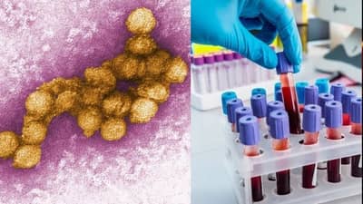 કોરોના બાદ હવે આવ્યો આ નવો વાયરસ, વેસ્ટ નાઇલ વાયરસનું તોળાતું સંકટ, જાણો તેના લક્ષણો