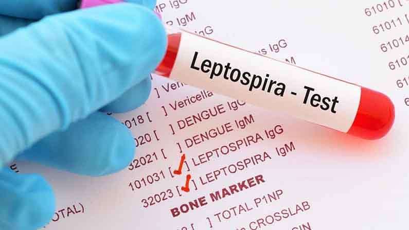 Health Care : ચોમાસામાં માથું ઉંચકતા લેપ્ટોસ્પાયરોસીસીનું કોને રહે છે વધારે જોખમ ? જાણો શું છે લક્ષણો