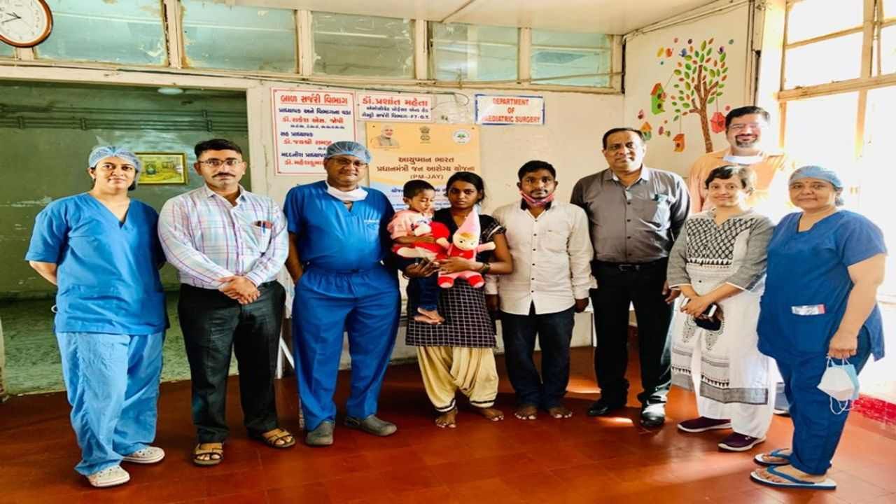 Ahmedabad: બાળકના આંતરડા બહાર કાઢી સર્જરી કરી કાઢવામાં આવ્યા સ્ક્રુ, સિવિલ હોસ્પિટલના તબીબોએ કર્યુ જટીલ ઓપરેશન