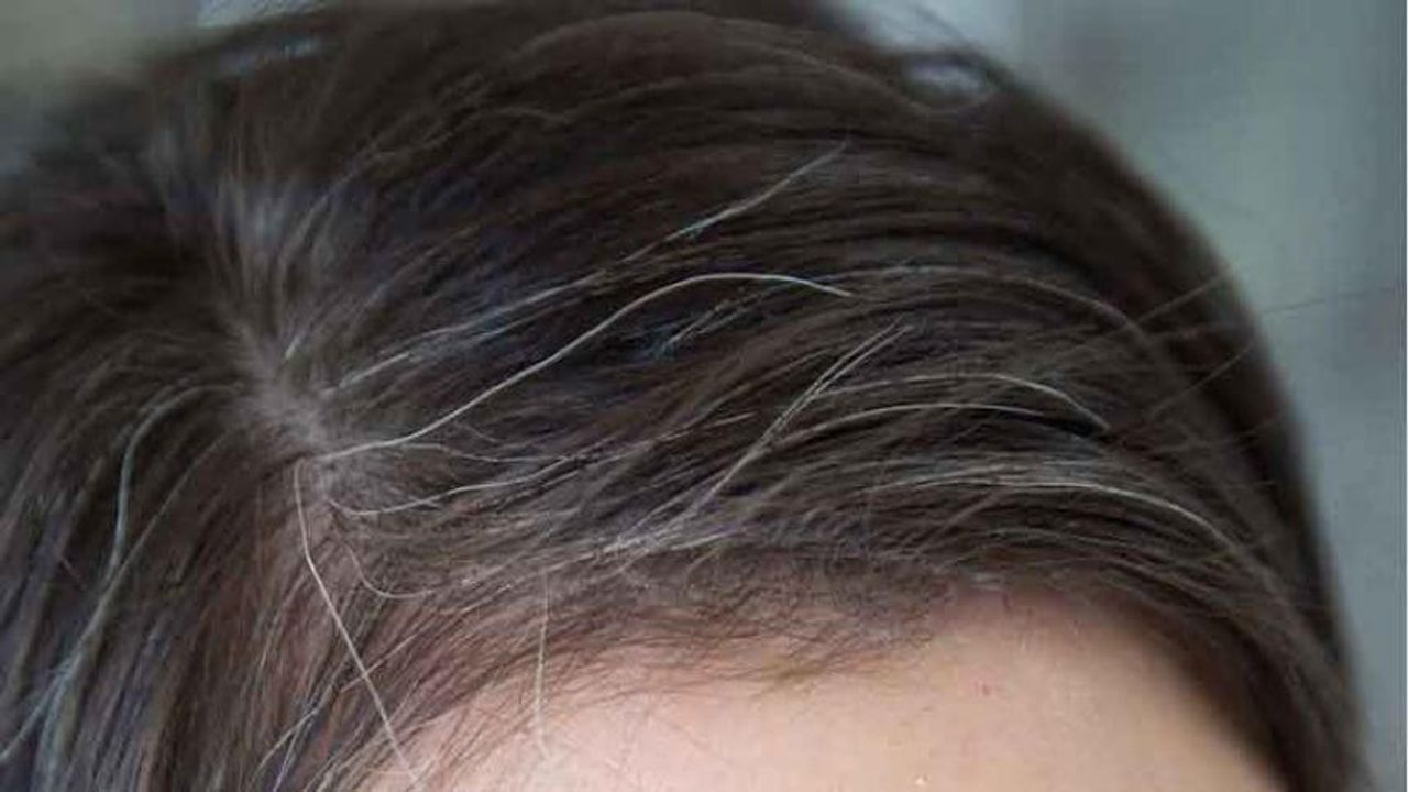 Beauty Tips : સફેદ વાળને કાળા કરવા કેવી રીતે કામ લાગે છે ફટકડી ? જાણો આ ઉપાય