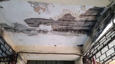 સુરતની સિવિલ હોસ્પિટલ છે કે અકસ્માતોનું ઘર? વધુ એક વખત સ્લેબના પોપડા પડતા ફફડાટ