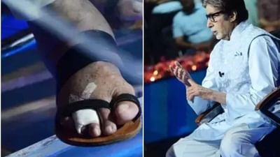 Kbc 13 : અમિતાભ બચ્ચનને પગની આંગળીમાં ફ્રેક્ચર થયું, છતાં કૌન બનેગા કરોડપતિ 13 નું શૂટિંગ કરવા પહોંચ્યા