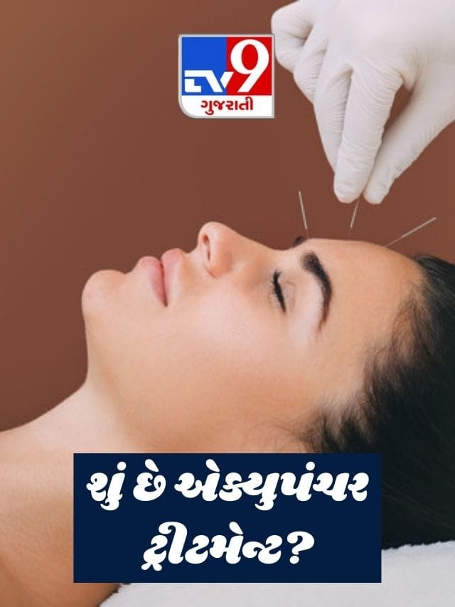 શું છે એક્યુપંચર ટ્રીટમેન્ટ? શું છે તેના ફાયદા