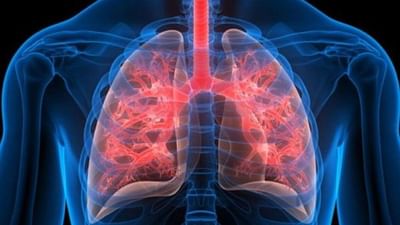 કેટલાક ખાસ ઉપાય અજમાવવાથી ફેફસાને પ્રદૂષણથી બચાવી શકાય, જાણો શું છે આ ખાસ ઉપાય