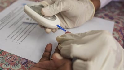 સીએમ ભૂપેન્દ્ર પટેલ શુક્રવારે લોન્ચ કરશે નિરામય ગુજરાત યોજના, રાજ્યના ત્રણ કરોડ લોકોને મળશે લાભ