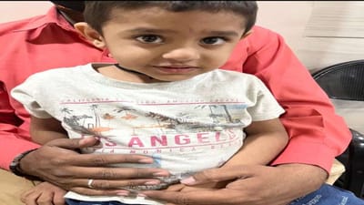 Rajkot: બાળકોના માતા-પિતા માટે આંખ ઉઘાડનારો કિસ્સો, બાળકના નાકમાં ઊંડે ઉતરી ગયો મેટલનો બોલ્ટ, પછી શું થયુ જુઓ આ વીડિયોમાં