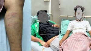 AHMEDABAD : ચાંદખેડા પોલીસ ફરી વિવાદમાં,  બે સગીરોને એવો ઢોર માર માર્યો કે હોસ્પિટલમાં દાખલ કરવા પડ્યા