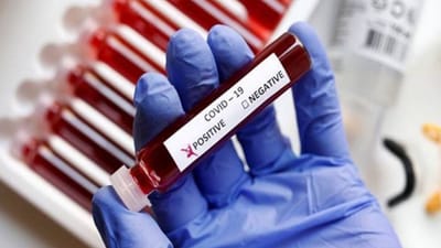 Ct Value of Omicron : શું છે ઓમિક્રોન વેરિઅન્ટની Ct Value ? વાંચો વિગત