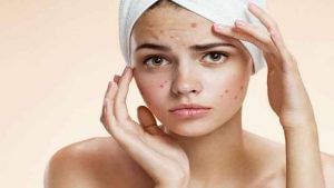 Beauty Tips: ત્વચાની સંભાળમાં ડુંગળીનો રસ શ્રેષ્ઠ માનવામાં આવે છે, આ સમસ્યાઓને કરે છે દૂર