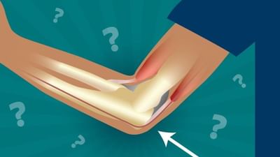 કોણી પર કોઈ વસ્તુ અથડાતાં અચાનક કરંટનો અહેસાસ થાય છે. તજજ્ઞો કહે છે કે, કોણીના આ હાડકાને સામાન્ય ભાષામાં ફની બોન્સ કહેવામાં આવે છે. જ્યારે આ હાડકું કોઈપણ સખત વસ્તુ સાથે અથડાય છે, ત્યારે તેના કારણે કરંટ આવે છે, તેનું મુખ્ય કારણ અલ્નાર નર્વ છે જે આ ભાગમાંથી પસાર થાય છે. આ હાડકાને ફની બોન્સ કેમ કહેવાય છે અને કરંટ જેવો આંચકો કેમ આવે છે, જાણો આ સવાલોના જવાબ…