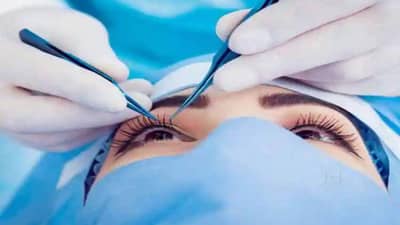 આંખમાં જીવતી માખી પ્રવેશી તો મહિલાને સારવાર માટે આવવું પડ્યું અમેરિકાથી ભારત