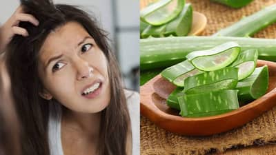 Itching relief tips: શું તમે સ્કેલ્પની ખંજવાળથી પરેશાન છો ? તો અજમાવો એલોવેરાના ઉપાય