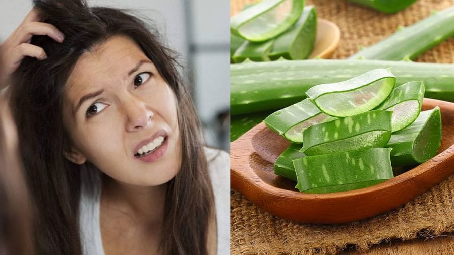Itching relief tips: શું તમે સ્કેલ્પની ખંજવાળથી પરેશાન છો ? તો અજમાવો એલોવેરાના ઉપાય