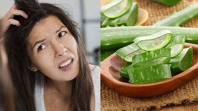 Itching relief tips: શું તમે સ્કેલ્પની ખંજવાળથી પરેશાન છો ? તો અજમાવો એલોવેરાના ઉપાય