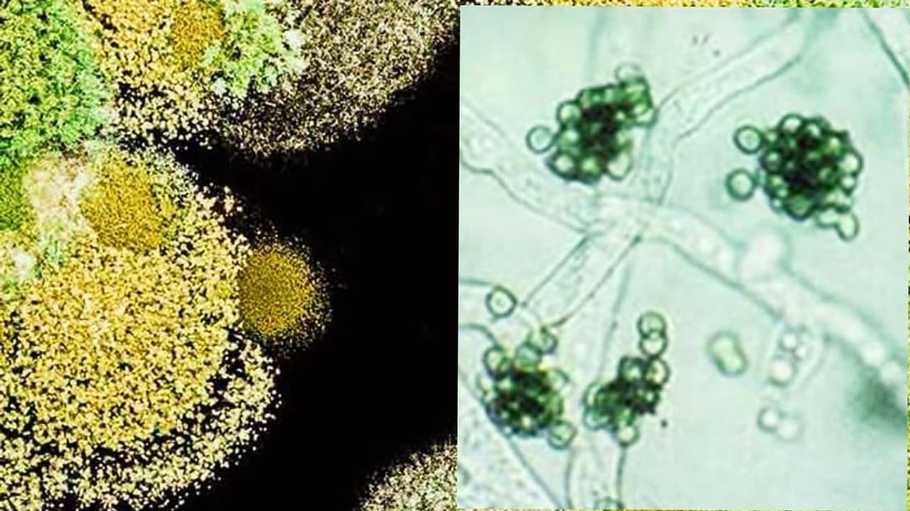 Trichoderma એક ફુગ જે છે ખેડૂતની છે સૌથી સારી મિત્ર, ઉત્પાદન વધારે અને ખર્ચમાં કરે છે ઘટાડો