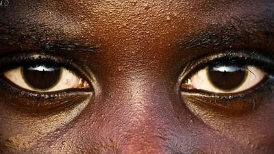 ચીનથી લઈને આફ્રિકા સુધી લોકોની આંખમાં ઘણો ફરક જોવા મળે છે. તેમની રચનામાં એટલો ફરક છે કે કોઈ વ્યક્તિ ચીનની છે કે જાપાનની છે કે પછી આફ્રિકાની છે તે આંખોથી ઓળખી શકાય છે. પરંતુ મોટો પ્રશ્ન એ છે કે અમુક દેશોના લોકોની દૃષ્ટિમાં આટલો તફાવત શા માટે છે? જાણો આ સવાલોના જવાબ….