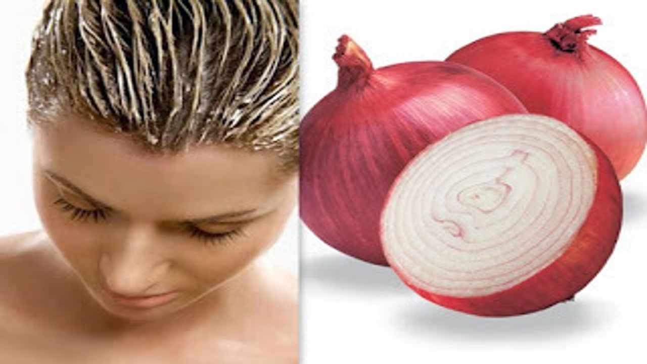 Onion Oil : કાંદાનું તેલ વાળમાં ખોડો અને વાળ ખરવા જેવી સમસ્યાઓને દૂર કરવા સાબિત થશે અકસીર ઈલાજ
