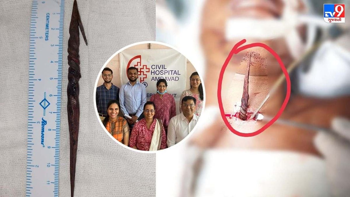 Ahmedabad: રાજસ્થાનની યુવતીના ગળામાં 12 સે.મી.ની લંબાઇનું લોખંડનું તીર ઘૂસી ગયુ અને પછી શું થયું જુઓ!