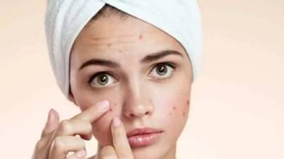 પીરિયડ્સ દરમિયાન કેમ થાય છે ખીલ ? અહીં જાણો તેનું કારણ અને ઉપાય