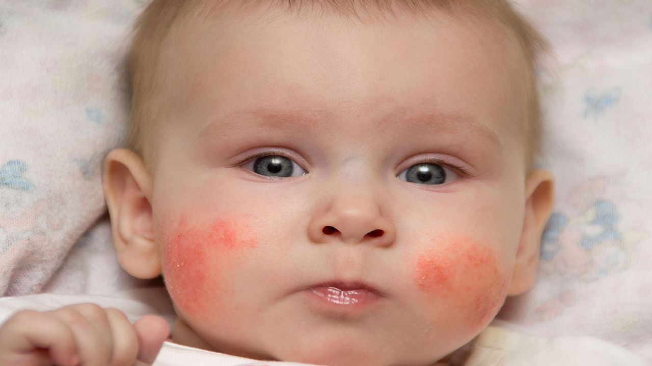 Baby Skin Care : બાળકોની સંવેદનશીલ ત્વચા પર લાલ ફોલ્લીઓ થવા પાછળનું કારણ જાણો