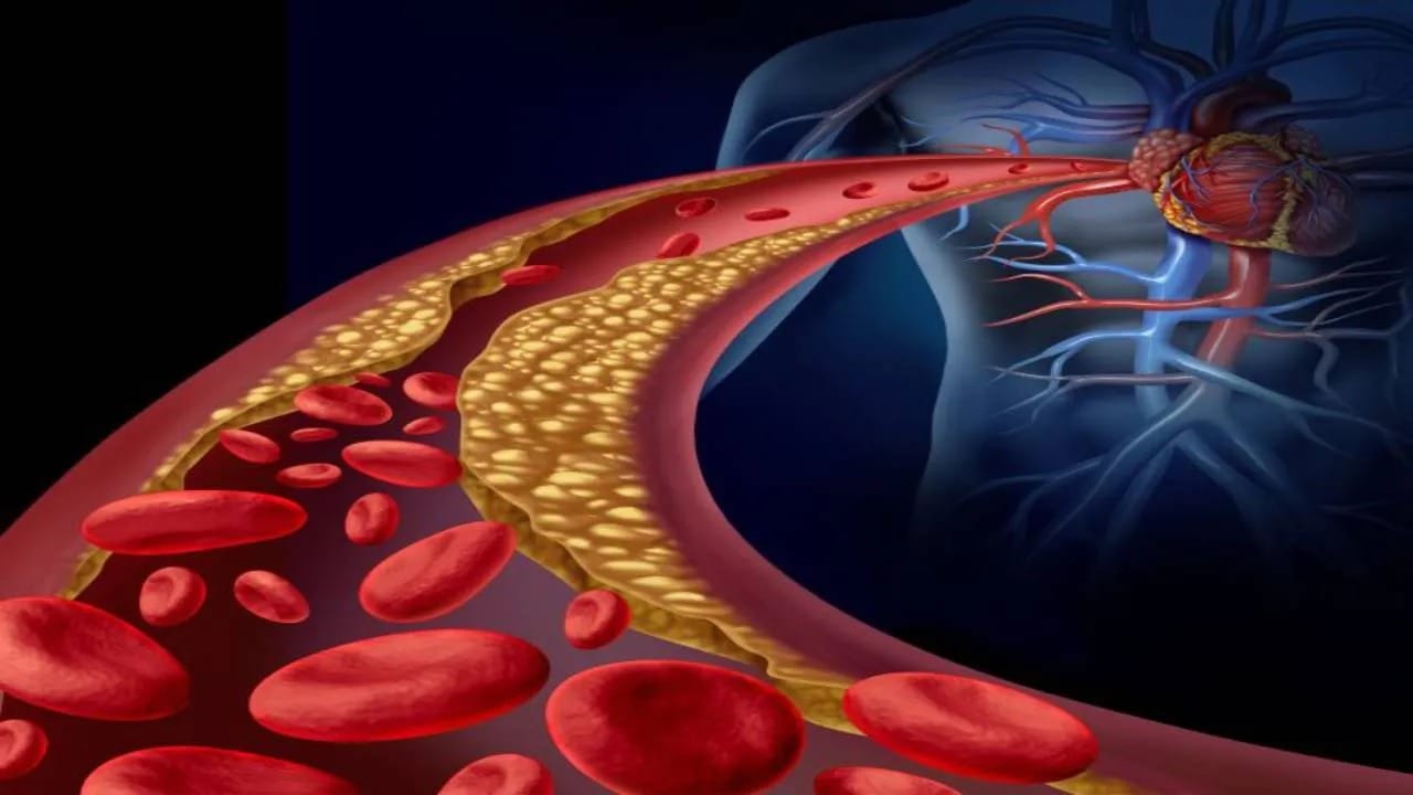 Clog Arteries: આ વસ્તુઓ નસોમાં ગંદકી ભરવાનું કામ કરે છે, બ્લોક થવાનું રહે છે જોખમ