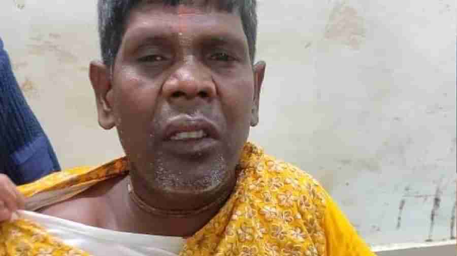 West Bengal: કાચા બદામ ગીતથી ચર્ચામાં આવેલા સિંગર ભુવન બડાઈકરને થયો અકસ્માત, હોસ્પિટલમાં દાખલ