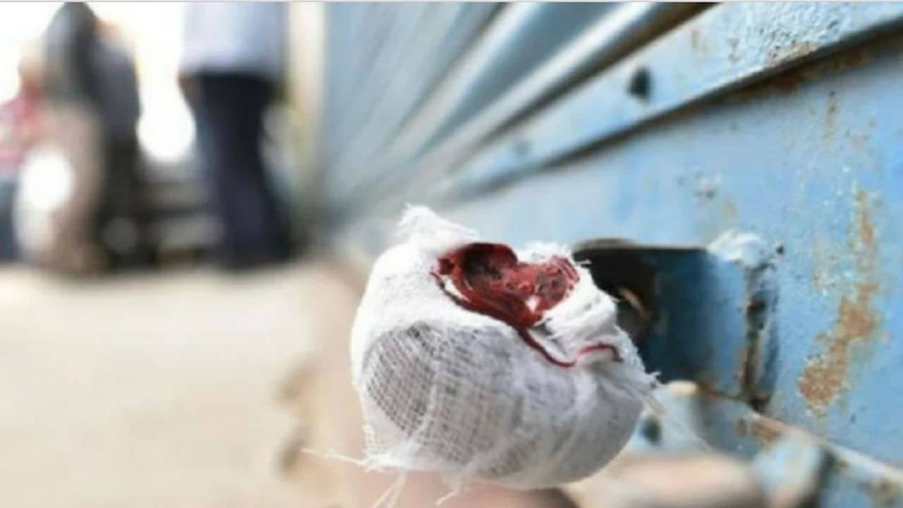 Surendranagar : પાટડી નગરપાલિકાની કડક કાર્યવાહી, વેરો નહિ ભરનાર 3 મિલકતને સીલ કરી