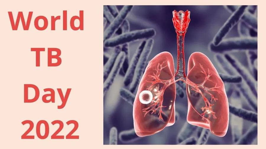 World TB Day 2022 : ટીબી સાથે જોડાયેલી આ 4 ગેરમાન્યતા, જે દરેકને જાણવી જરૂરી છે