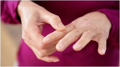 Vitamin D : શરીરમાં આ લક્ષણો દેખાય છે તો હોય શકે છે વિટામિન ડીની ઉણપ