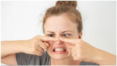 Beauty Tips: બ્લેકહેડ્સ અને વ્હાઇટહેડ્સથી છુટકારો મેળવવા અપનાવો આ ઘરેલુ ઉપચાર