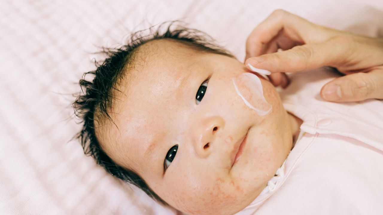 Child Skin Care : બાળકના ચહેરા પર થયેલી એલર્જી બાબતે આ વાતોનું ધ્યાન રાખો