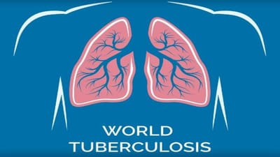 આજે વિશ્વ ક્ષય દિવસઃ ટીબીની વહેલી સારવાર થાય તો રોગને ફેલાતો અટકાવાની સાથે મૃત્યુદર ઘટાડી શકાય